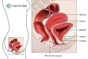 How EM Chair treatment Byfleet can help Leaky bladder issues. Read more now!