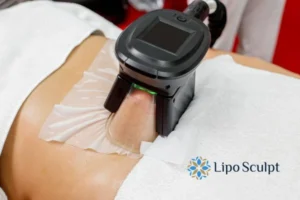Does Fat Freezing At Home Work? 3 Fat freezing at home from Lipo Sculpt Byfleet
